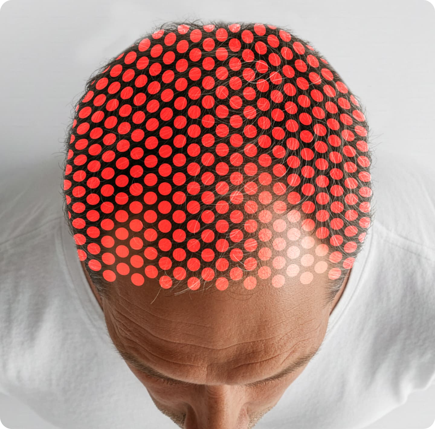 302 Laser Cap